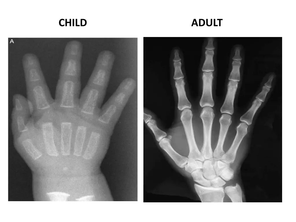 child 1