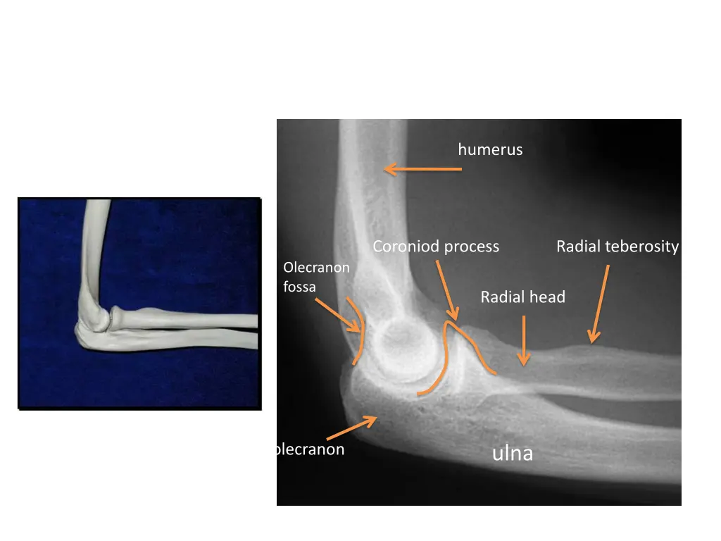 humerus