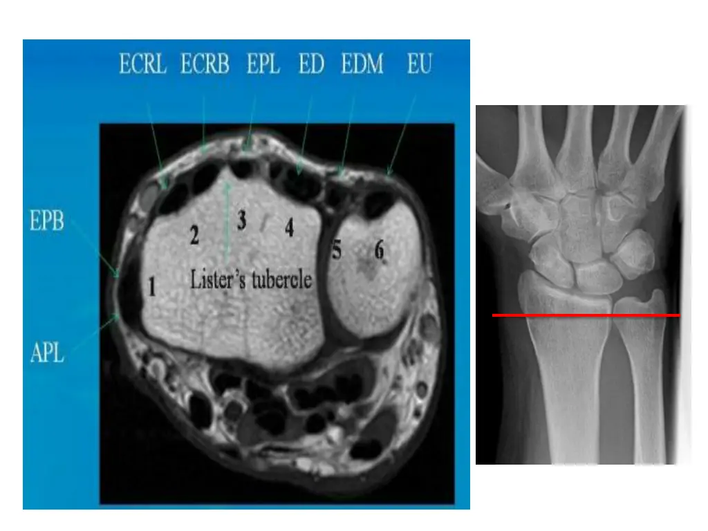 slide26