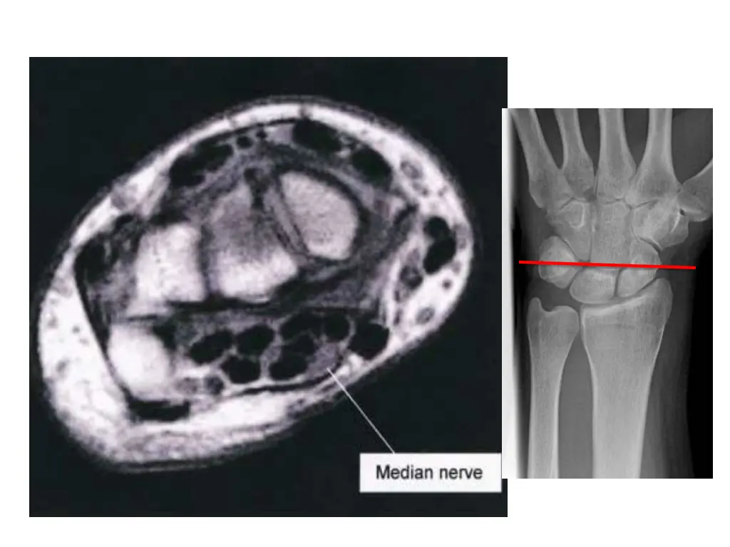 slide27