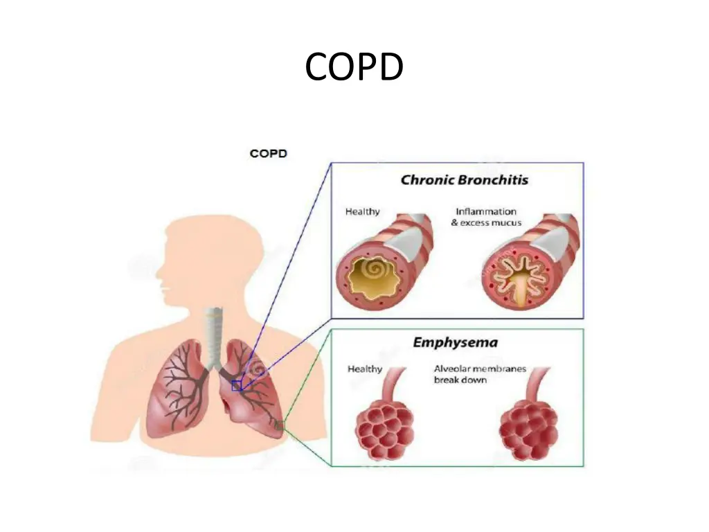 slide25