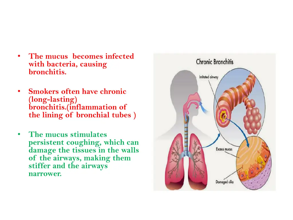 slide27