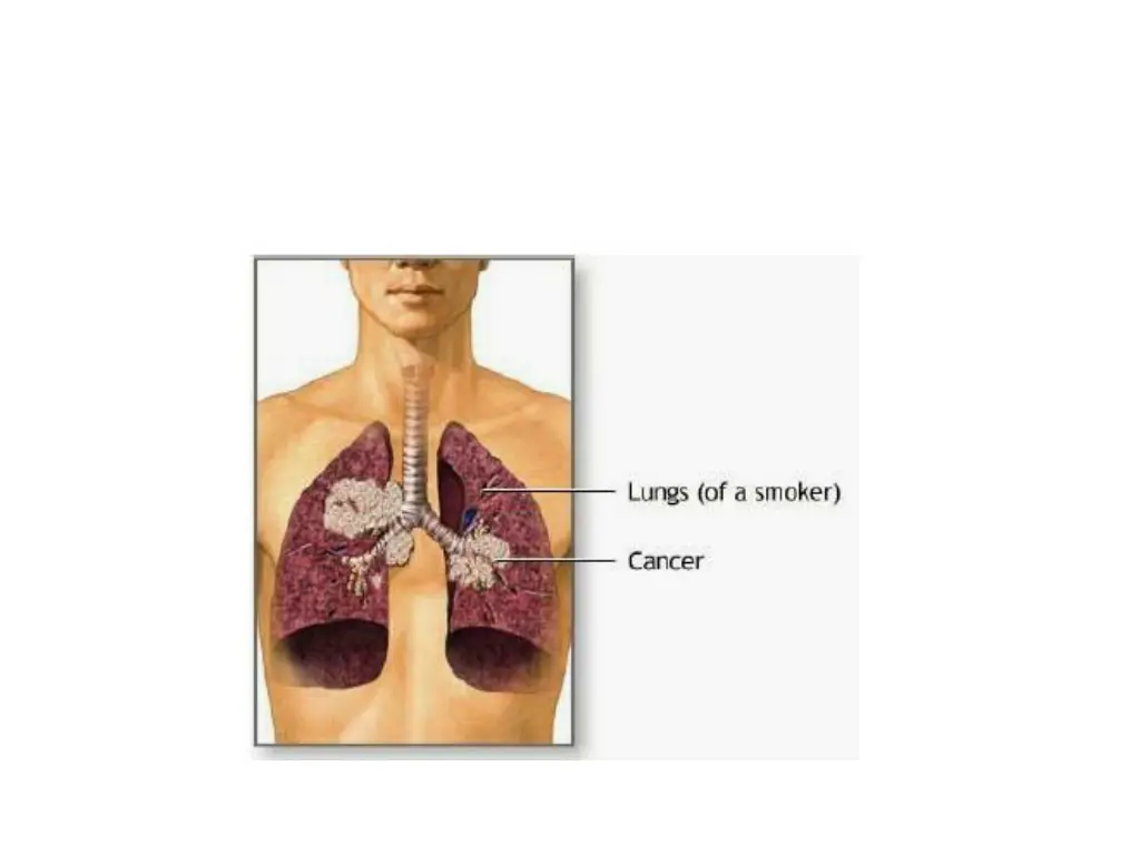 slide42