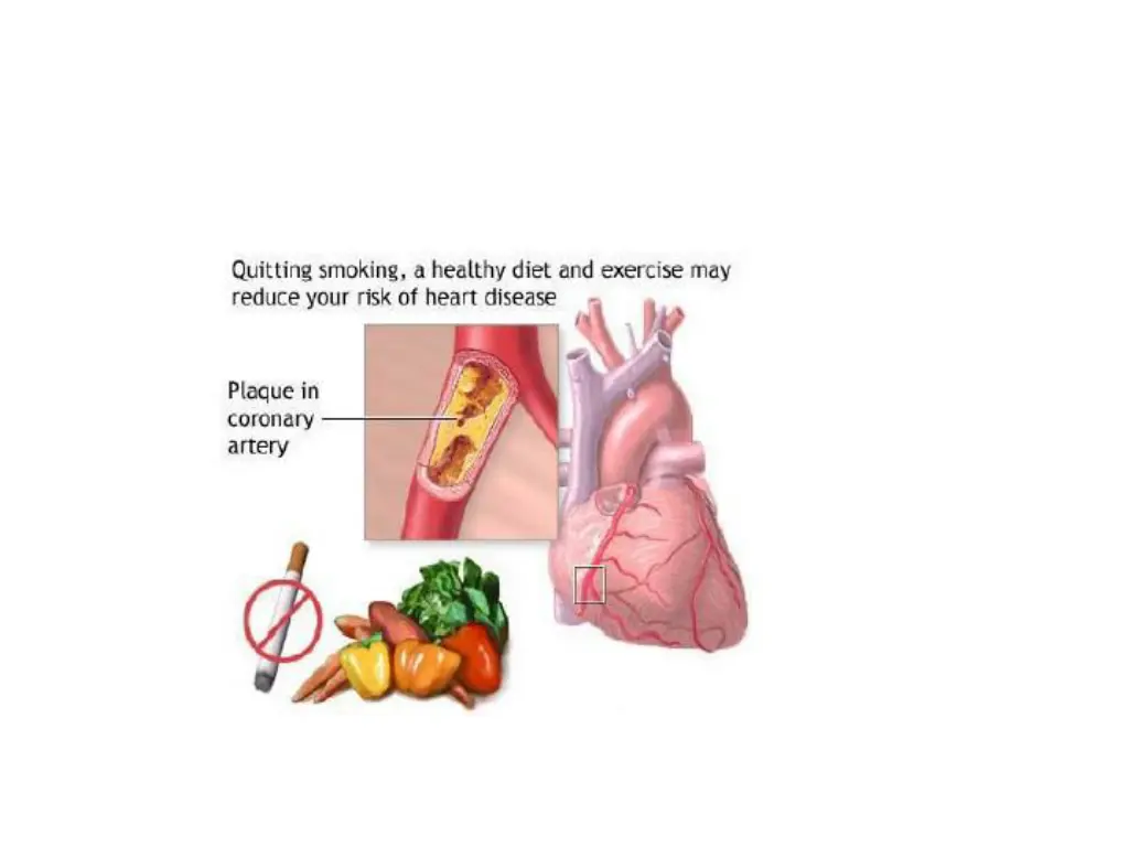 slide49