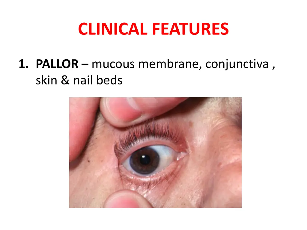 clinical features