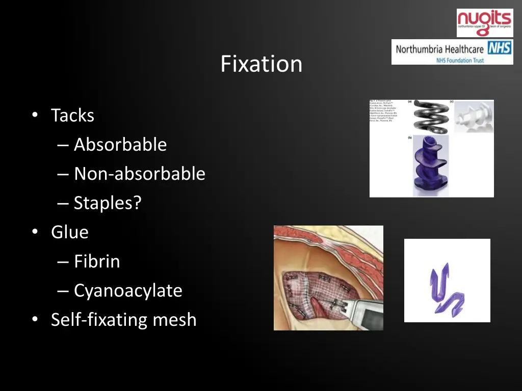 fixation