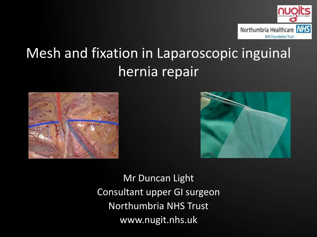 mesh and fixation in laparoscopic inguinal hernia
