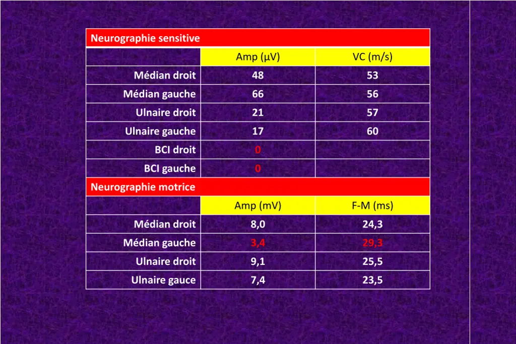 neurographie sensitive