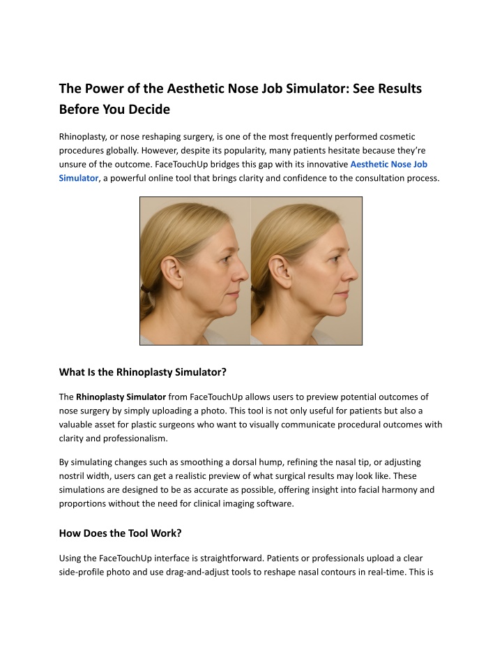the power of the aesthetic nose job simulator