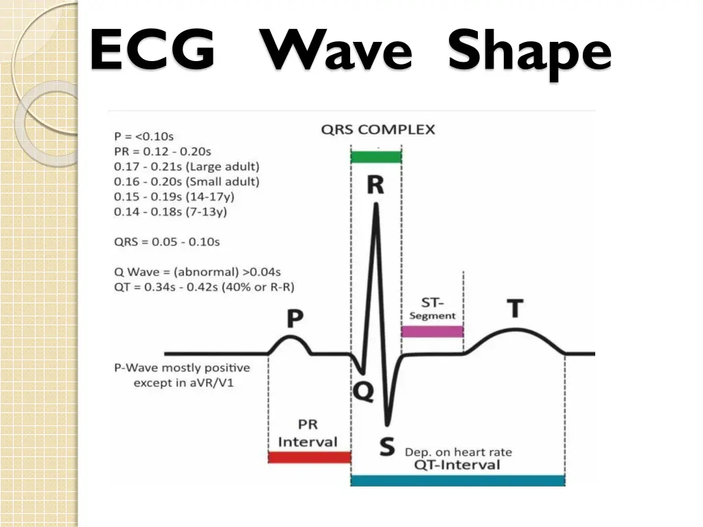 ecg wave shape