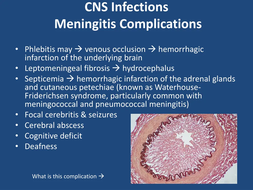 cns infections meningitis complications