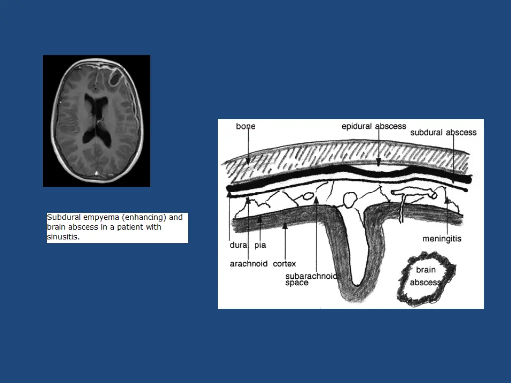 slide14