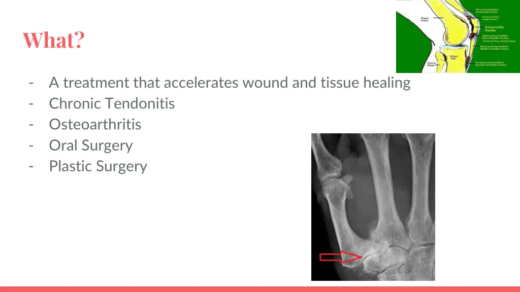 slide2