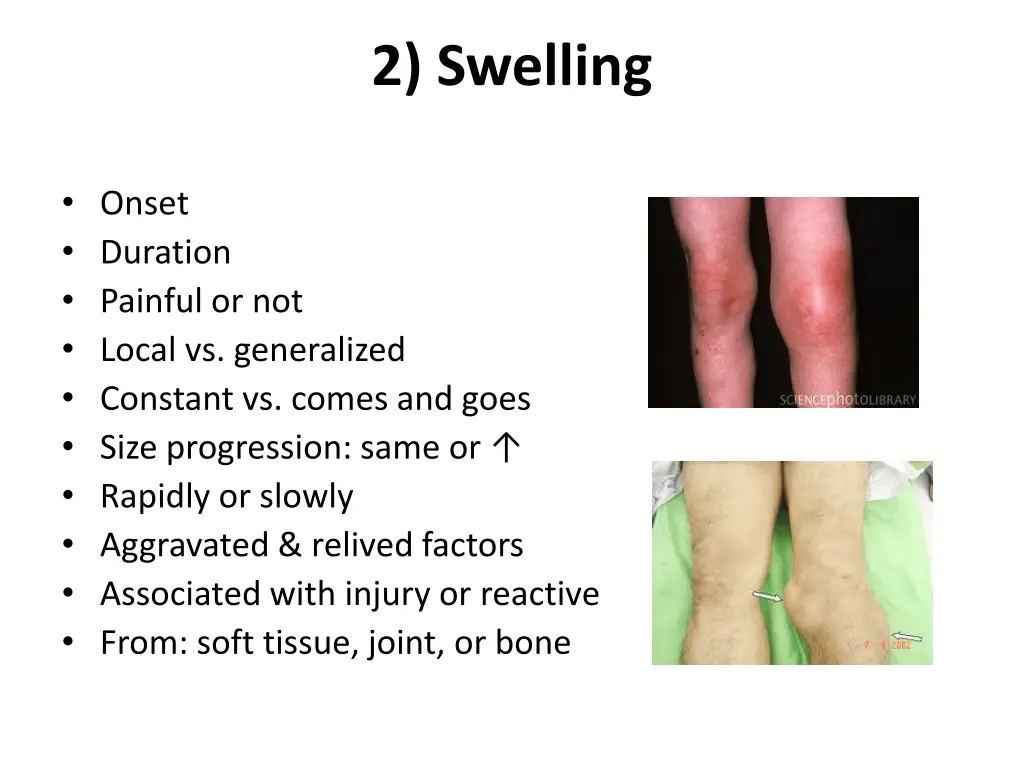 2 swelling