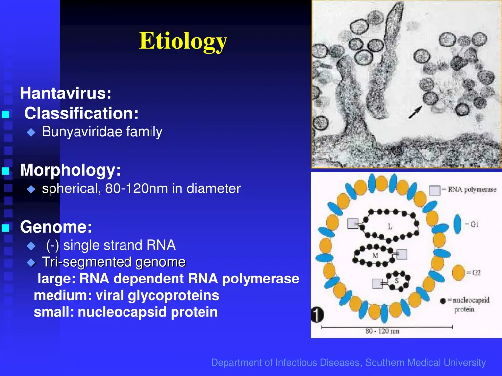 etiology