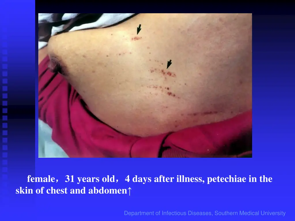 female skin of chest and abdomen