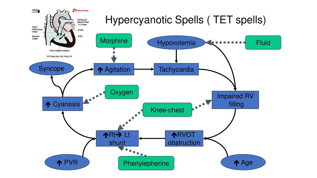 hypercyanotic spells tet spells