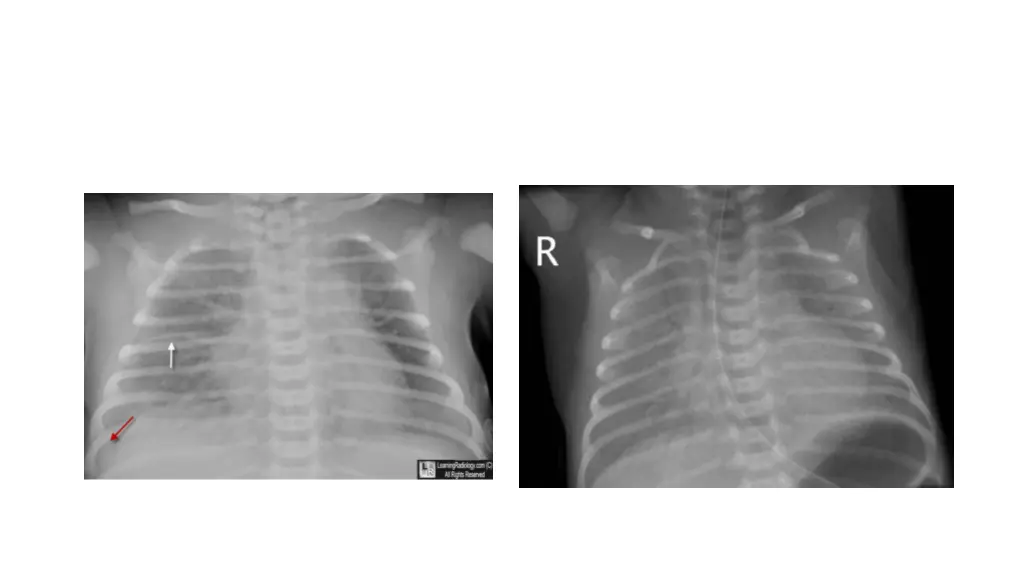 slide12