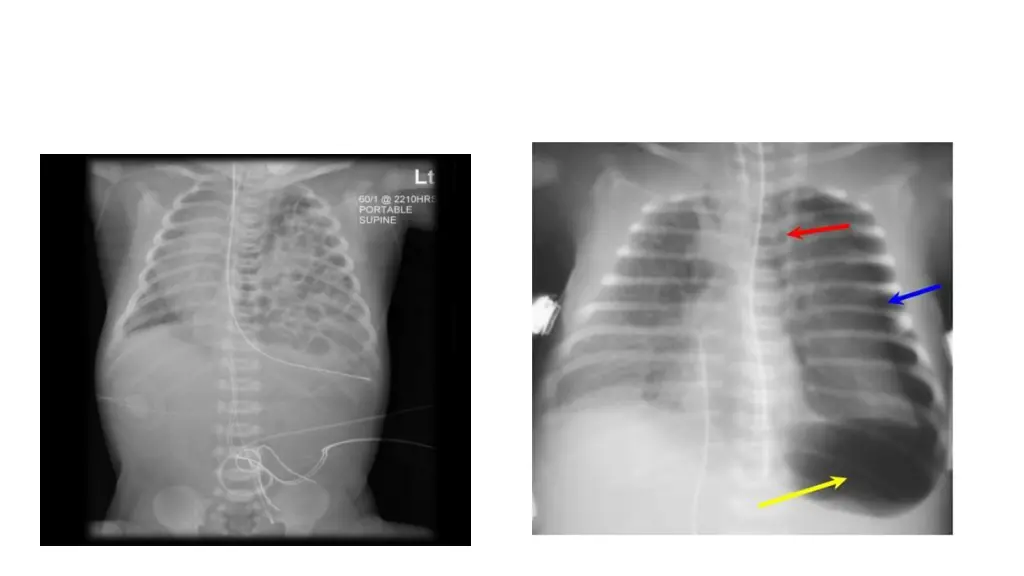slide13