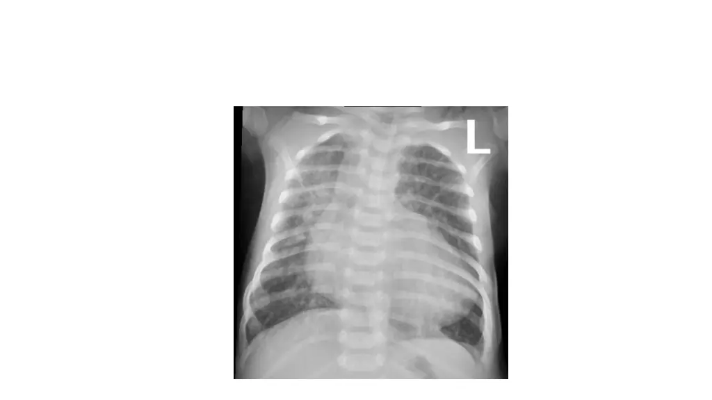 slide20