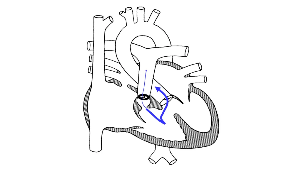 slide29