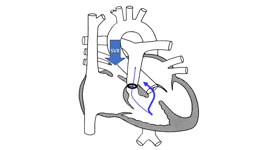 slide30