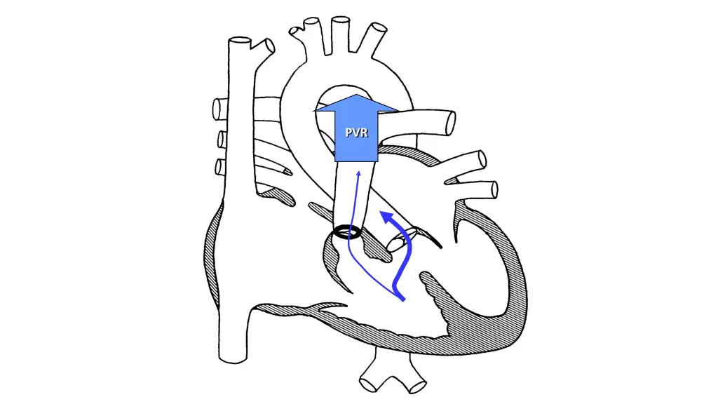 slide31