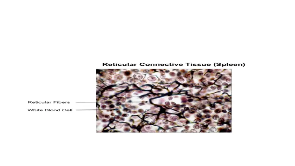 image result for reticular connective tissue