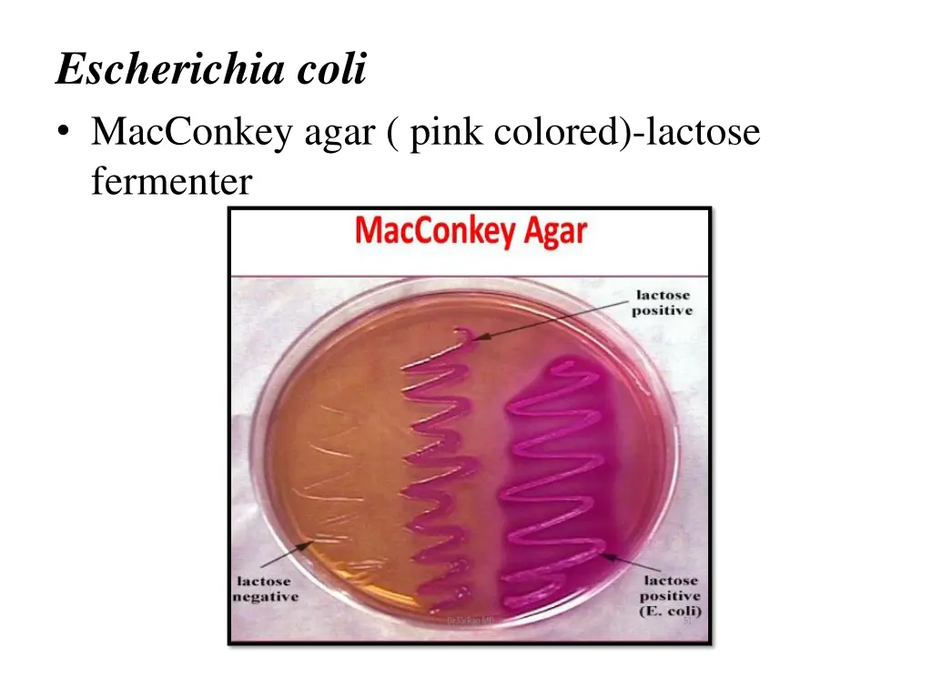 escherichia coli macconkey agar pink colored