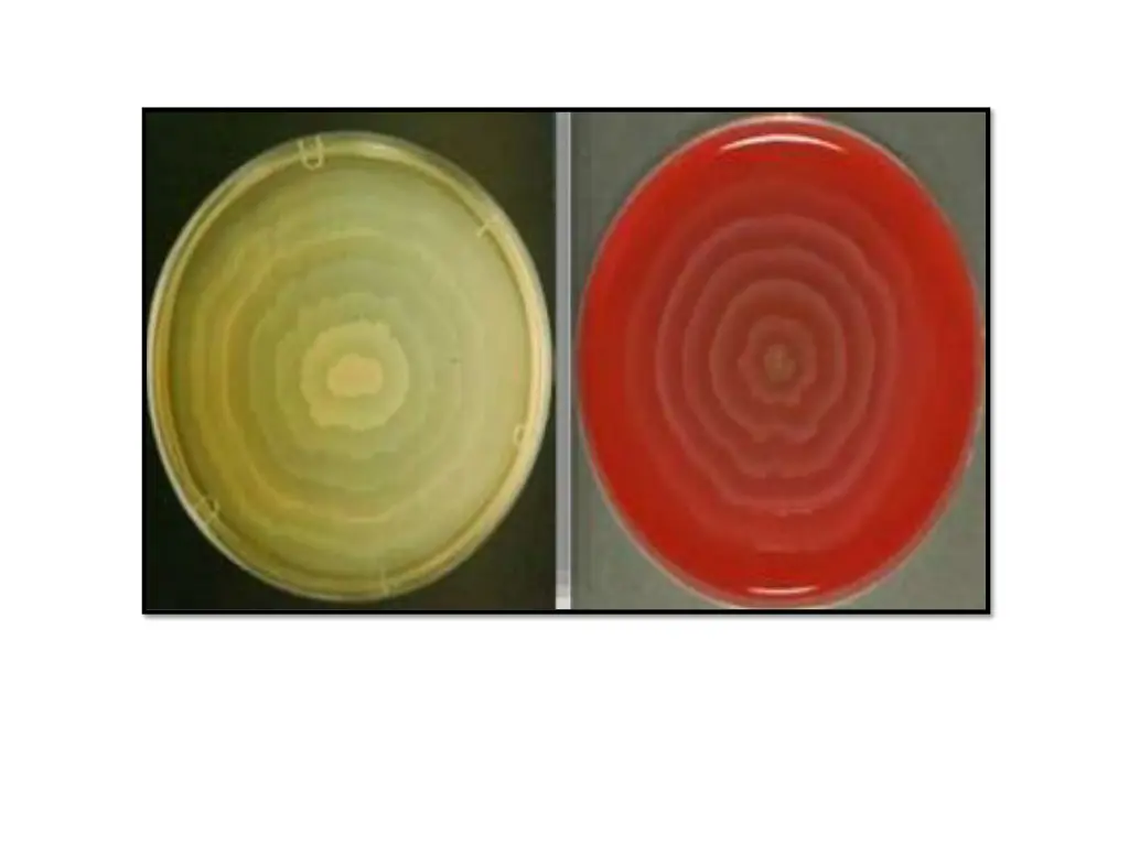 slide17
