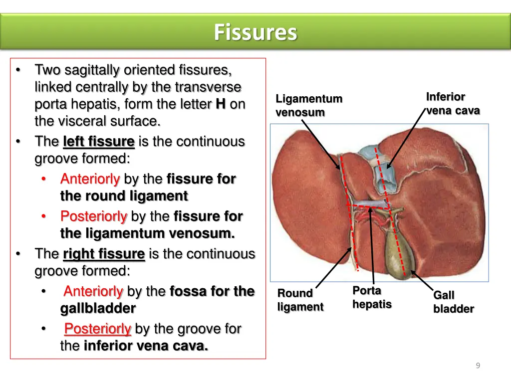 fissures