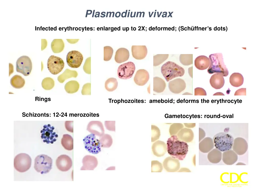plasmodium vivax