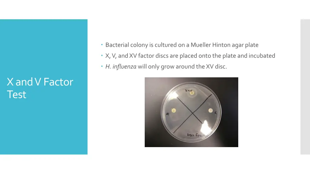 bacterial colony is cultured on a mueller hinton