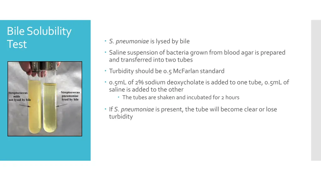 bile solubility test