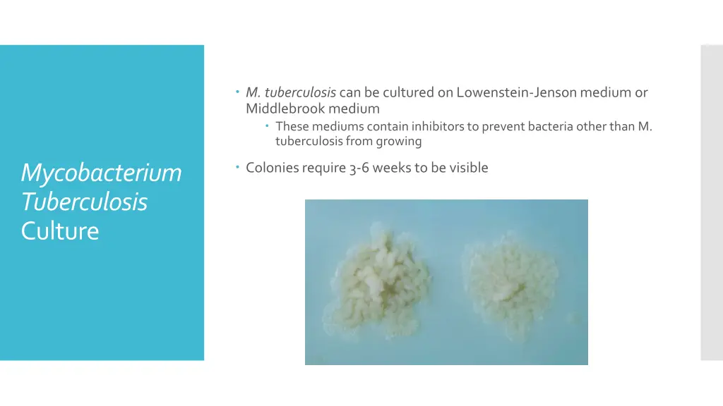 m tuberculosis can be cultured on lowenstein