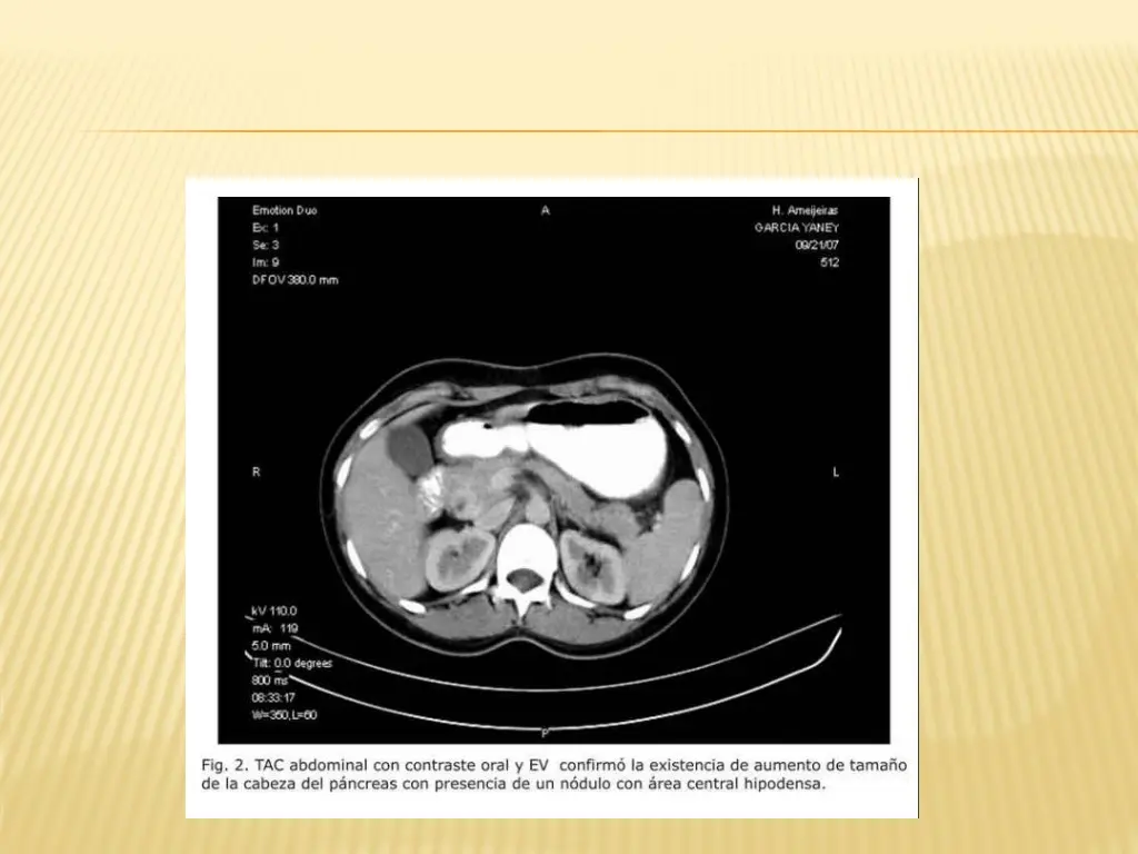 slide8
