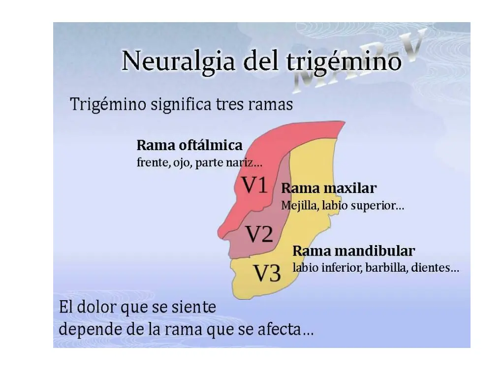 slide5
