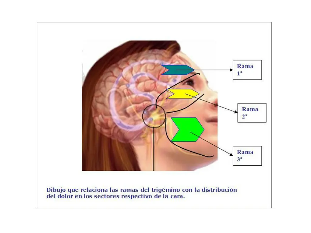 slide7