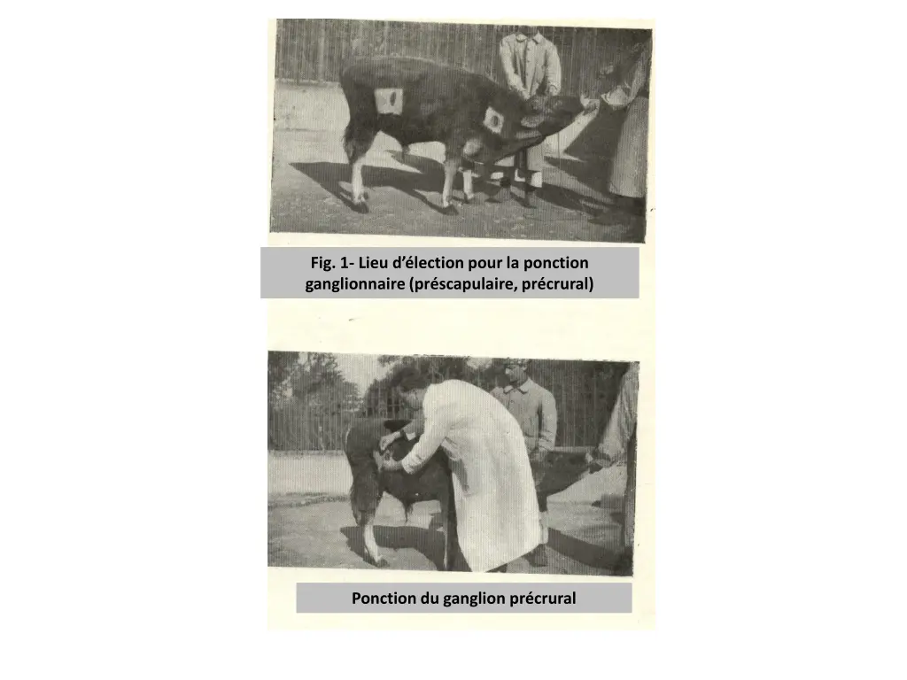fig 1 lieu d lection pour la ponction