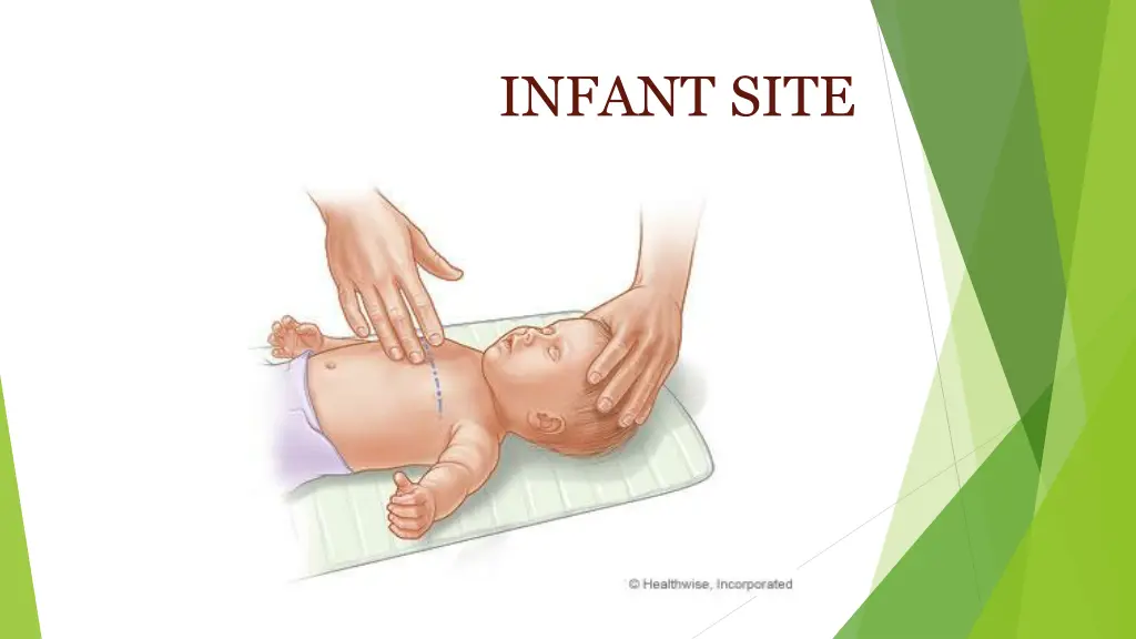 infant site