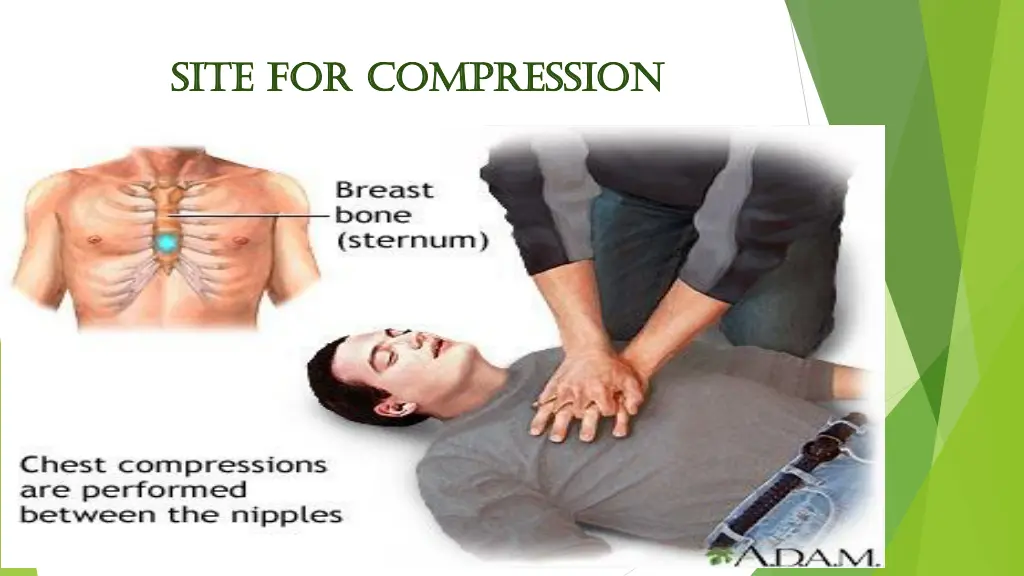 site for compression site for compression