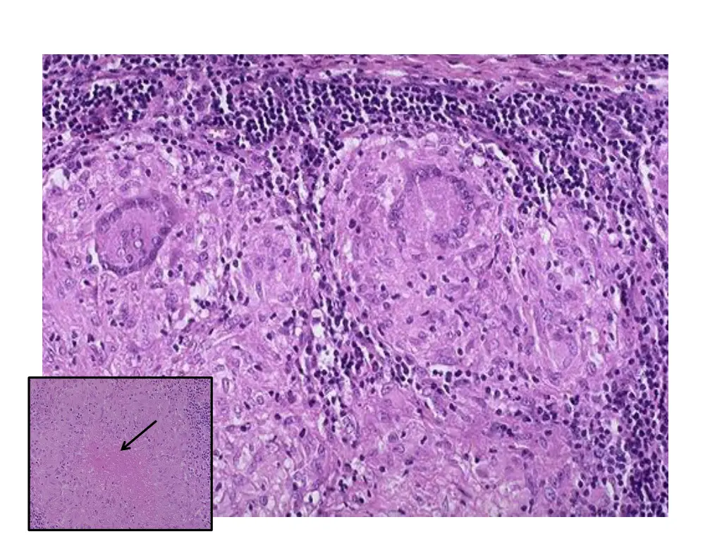 slide14