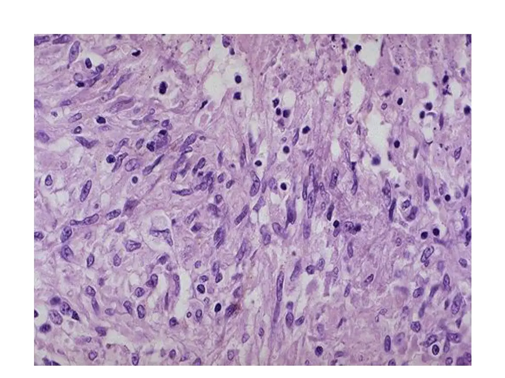 slide15