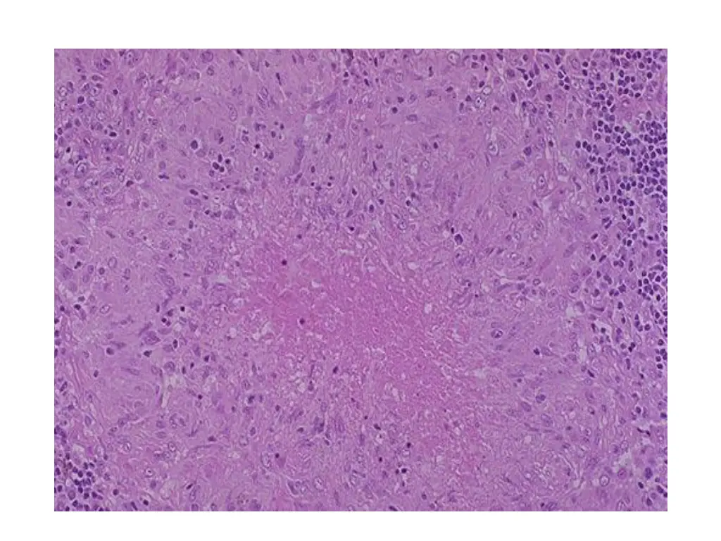 slide16
