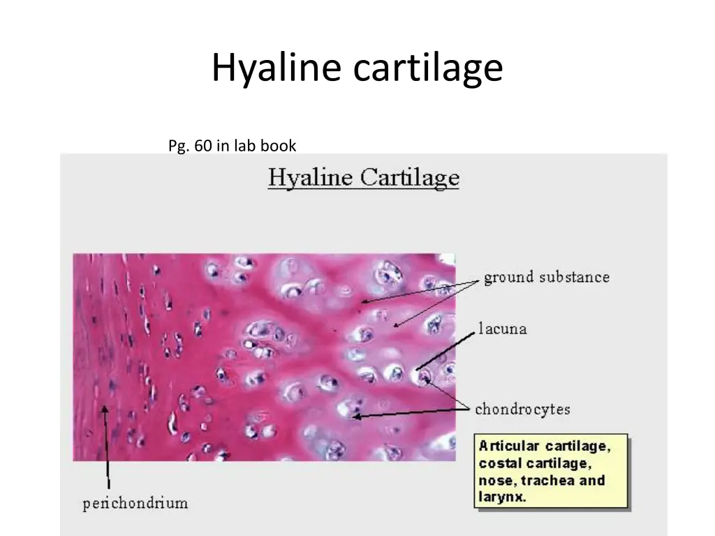 hyaline cartilage