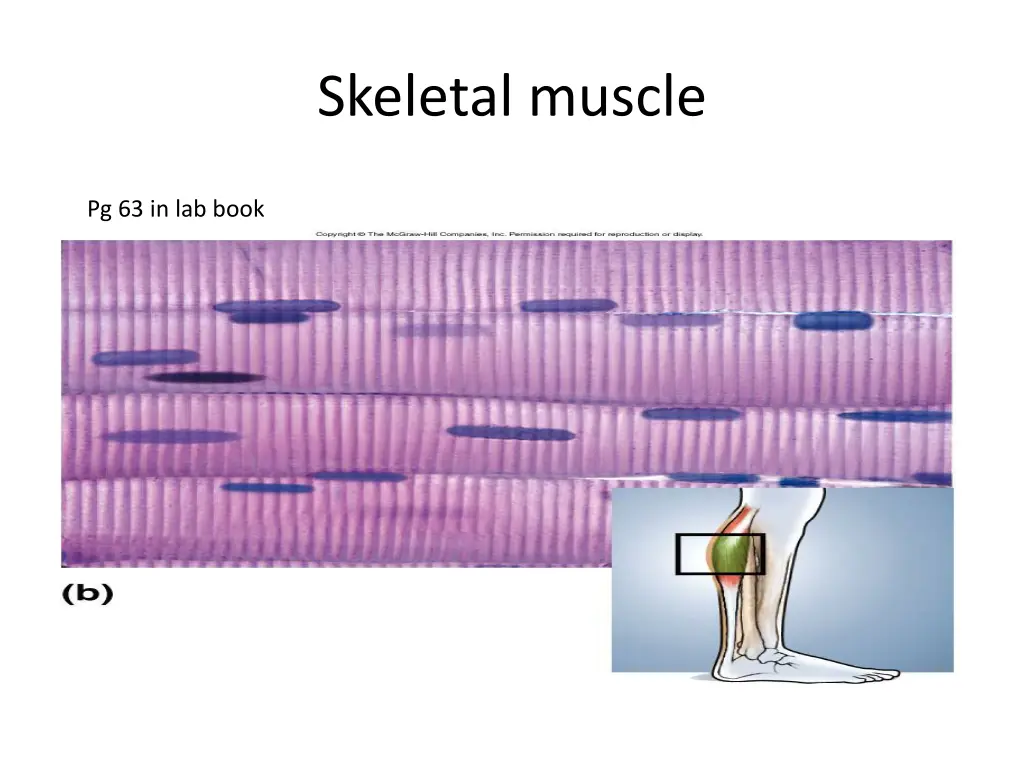 skeletal muscle