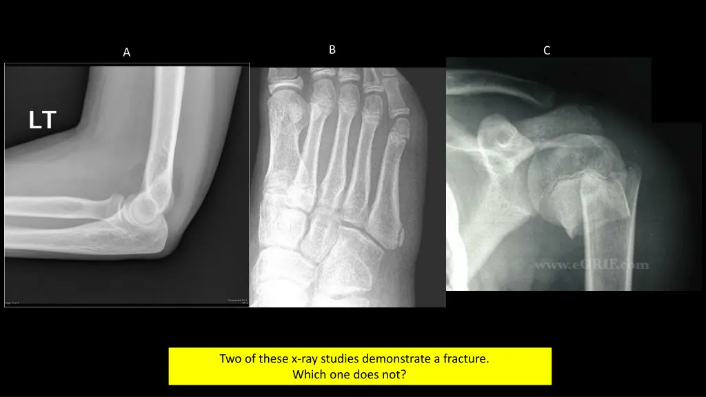 slide9