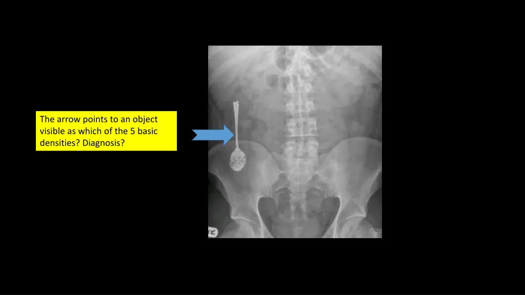 the arrow points to an object visible as which