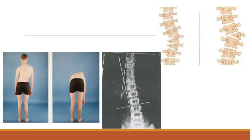 slide3