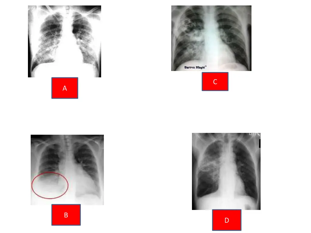 slide4